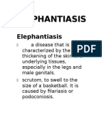 Elephantiasis