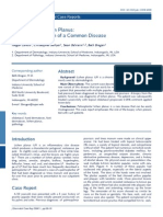 Palmoplantar Lichen Planus: A Rare Presentation of A Common Disease