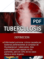 Tuberculosis Pulmonar Extrapulmonar y Taes 1222991960401355 9