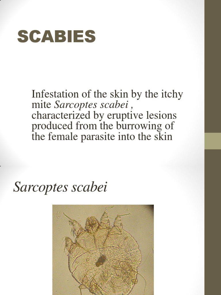 Scabies Presentation PDF Clinical Medicine Medical Specialties