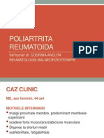 POLIMIOZITA