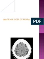 1 . Imagenologia Cerebral