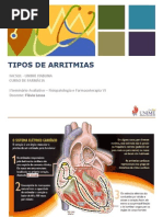 Apresentação Tipos de Arritmias