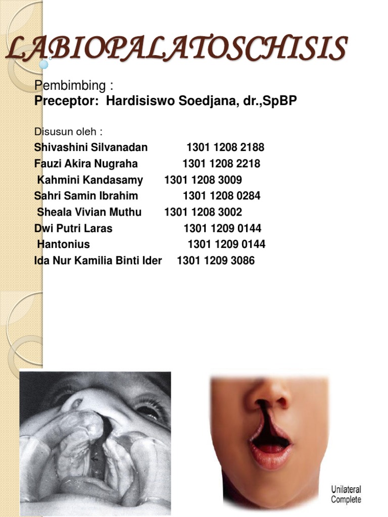 Klasifikasi dan Penanganan Labiopalatoschisis | PDF