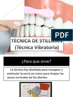 Tecnica de Stillman