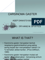 Carsinoma Gaster 