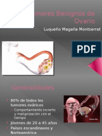 Tumores Benignos de Ovario