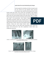 Pengaruh Faktor Iatrogenik Dalam Perawatan Endodontik Pada Jaringan Periodontal