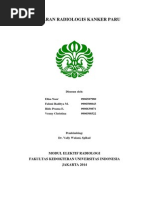 Download Gambaran Radiologi Karsinoma Paru by Fahmi Radityamurti SN234357249 doc pdf