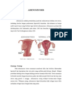 ADENOMYOSIS