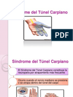 Síndrome Del Túnel Carpiano