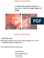 Gastric Carcinoma