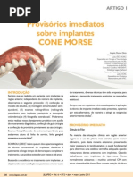 ARTIGO 01 Provisorios Imediatos Sobre Implantes CM