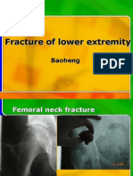 Fracture of Lower Extremity Fracture of Lower Extremity