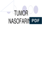 Sss155 Slide Tumor Nasofaring