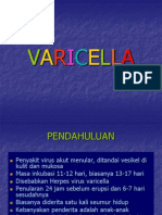 Varicella