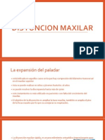 Disyuncion Maxilar