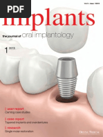 Download Implants by Dabala Harish Reddy SN235221002 doc pdf
