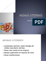 Miomas Uterinos