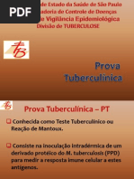 Aula05dots Prova Tuberculinica