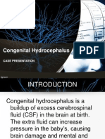 Congenital Hydrocephalus: Case Presentation