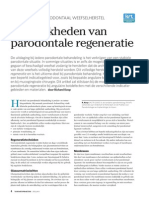 Mogelijkheden Van Parodontale Regeneratie