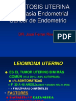 Miomatosis Uterino SA1