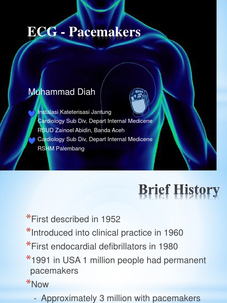 Understanding Heart Pacemakers and ECG | PDF | Artificial Cardiac ...