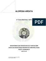 Alopecia Areata