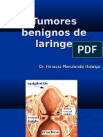 Tumores Benignos Laringe