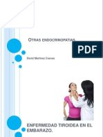 Otras Endocrinopatias - Tiroides