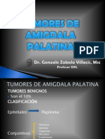 Tumores de Amigdala Palatina Fina