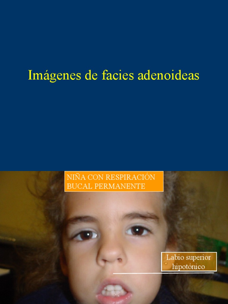 Facies Adenoideas | PDF | Anatomia animal | Odontología, image size:768x1024