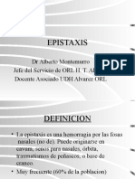 Epistaxis Manejo