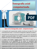 Tomografiaaxialcomputarizada 110824161651 Phpapp01 3