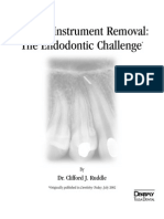 Instrumen Endodontik Patah