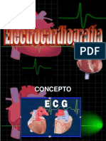 EKG Electrocardiografia