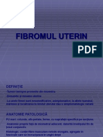 Fibromul Uterin1