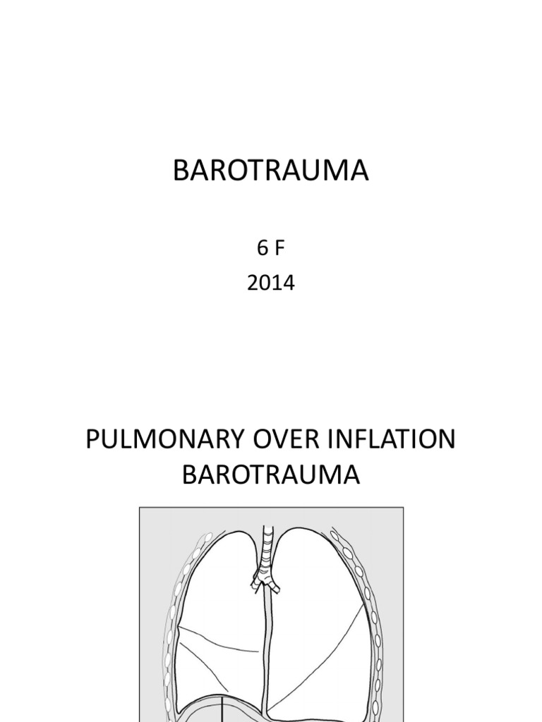 Sinus Barotrauma Todo PDF Clinical Medicine Medical Specialties
