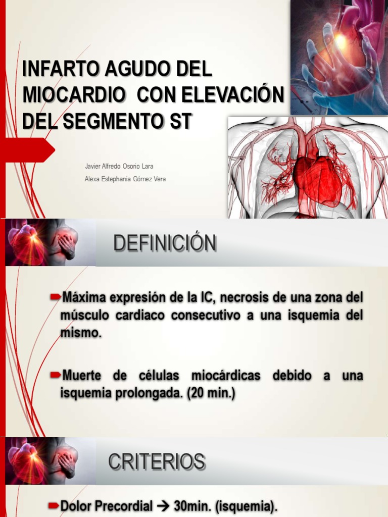 Infarto Agudo Del Miocardio Con Elevación Del Segmento | Descargar ...