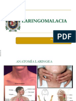 LARINGOMALACIAeditado