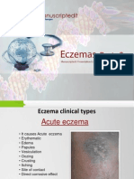 Eczemas: Part - 3