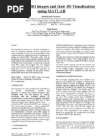 Download Paper for MRI Images Using MATLAB by ankitmlvtec SN23613347 doc pdf