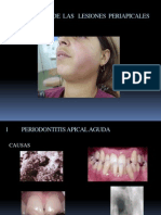 Diagnostico de Las Lesiones Periapicales