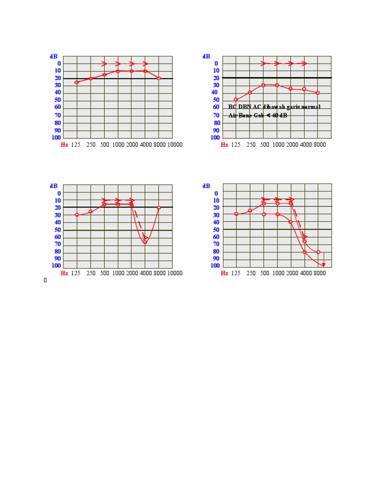 Sound Level Measurement Chart | PDF