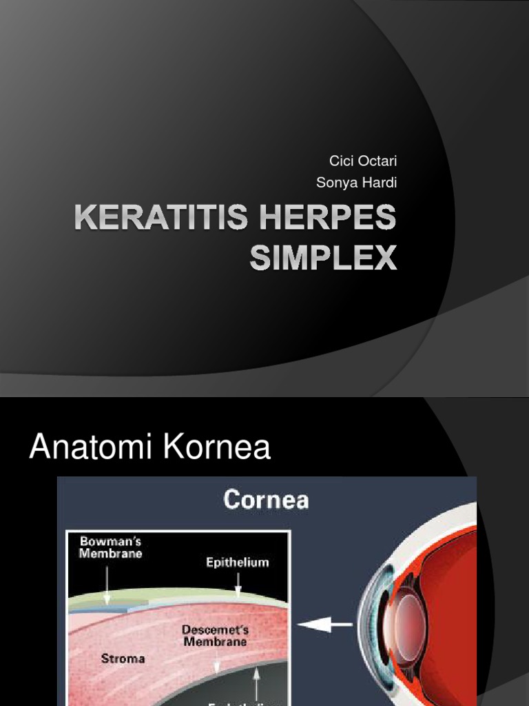 Keratitis Herpes Simplex-Hsv | PDF