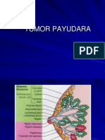 1 Tumor Payudara