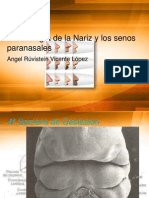 Embriología de La Nariz y Los Senos Paranasales