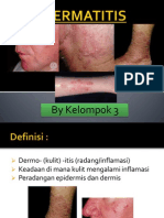 Dermatitis