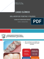 Sellador Caso Clinico